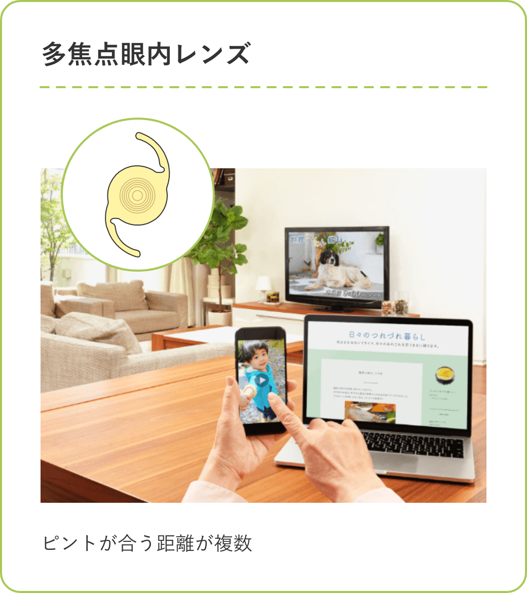 多焦点眼内レンズ