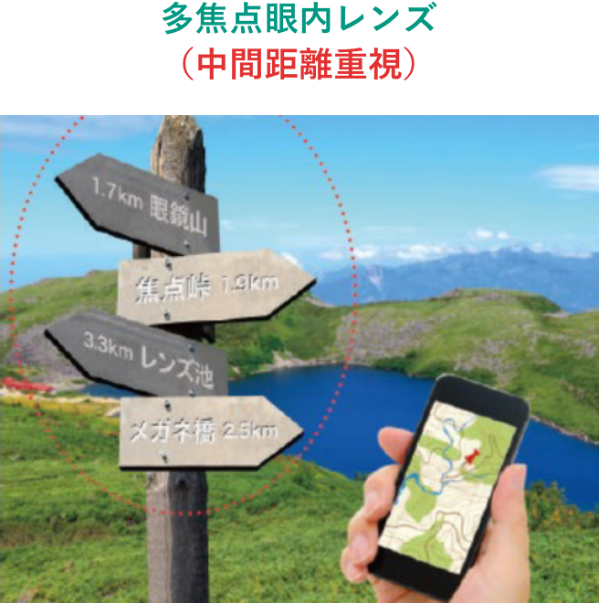 多焦点眼内レンズ（中間距離重視）