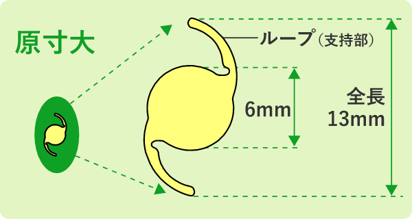 眼内レンズ