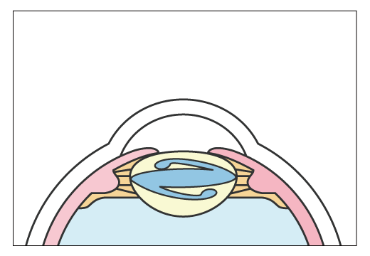 手術4